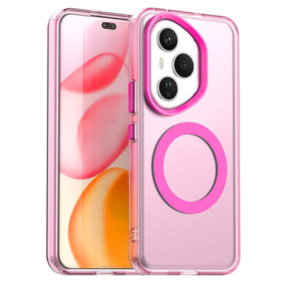 MagSafe-Hülle für Honor 400 Pro, Techsuit, CandyCase, Rosa